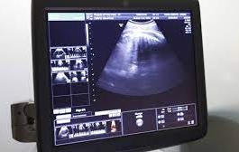 Exploring the World of Ultrasound Applications