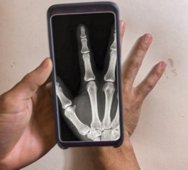 在手机上拍摄 X 光片的神奇应用程序