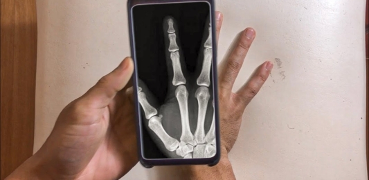 Aplicativos Incríveis para Tirar Radiografias no Celular